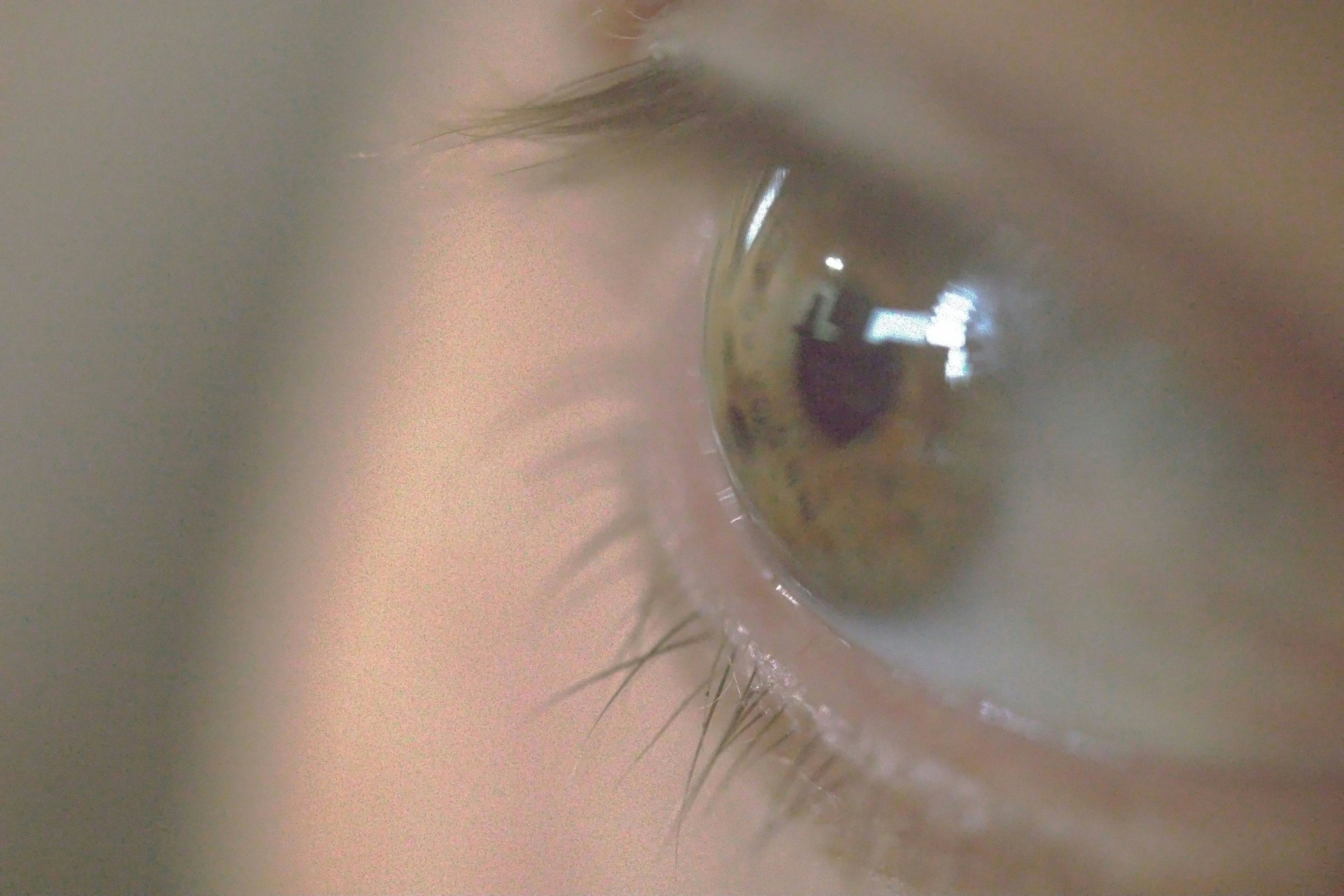 a close up view of a person's eye